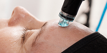 HydraFacial | Spa Radiance Day Spa | San Francisco