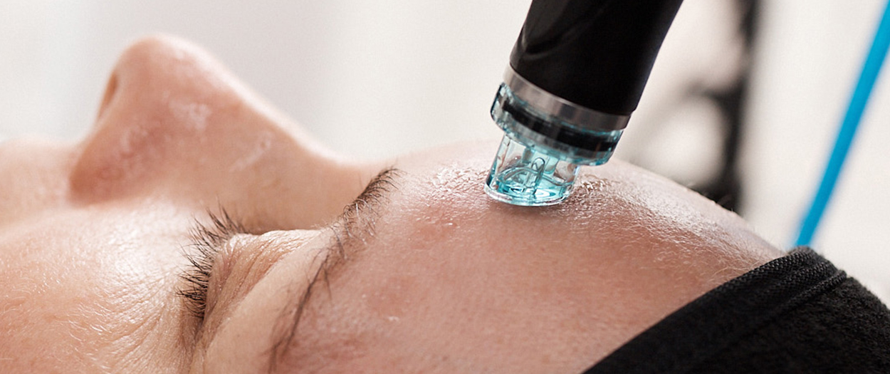HydraFacial | Spa Radiance Day Spa | San Francisco