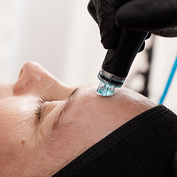 HydraFacial | Spa Radiance Day Spa | San Francisco